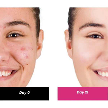 ThriveCo 2% Salicylic acid Serum, 30 ML