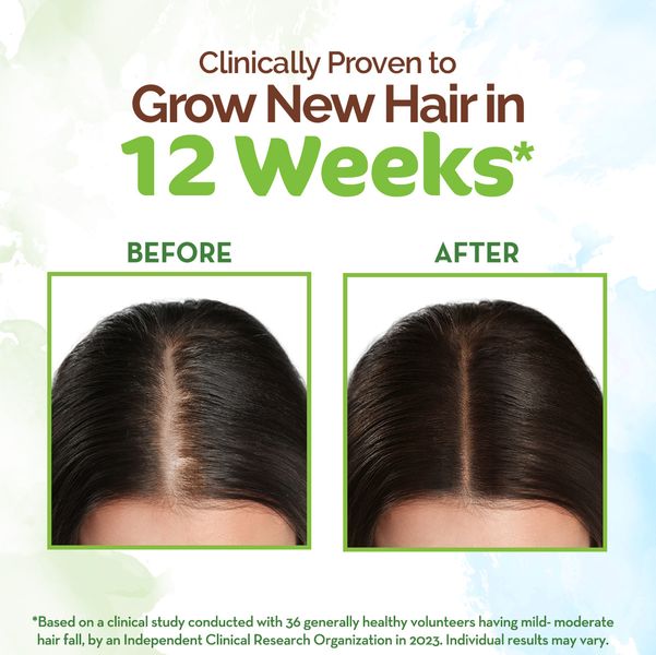 Mamaearth Rosemary Hair Growth Oil with Rosemary & Methi Dana, 150 ML