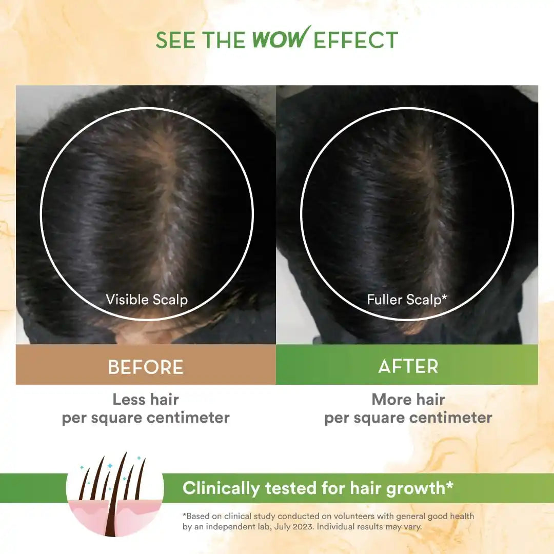 WOW SKIN SCIENCE ROSEMARY WITH BIOTIN SHAMPOO, 250 ML